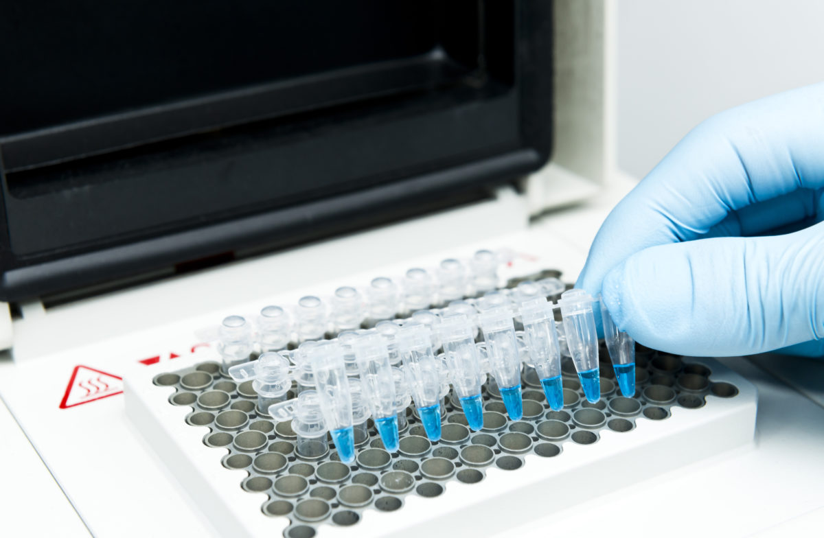 A researcher put a strip of 8 PCR tubes on the thermal cycler for DNA amplification